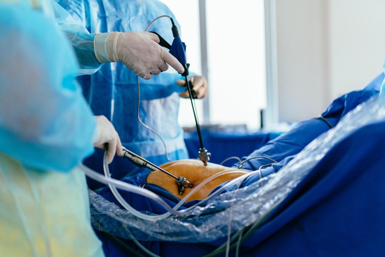 Laparoscopic Surgeries